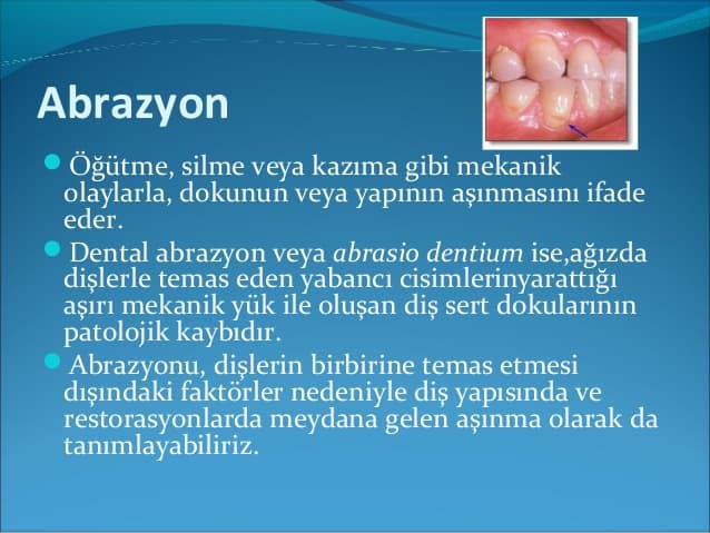 Abrazyon Nedir, Abrazyon Anlamı kitabının kapağı